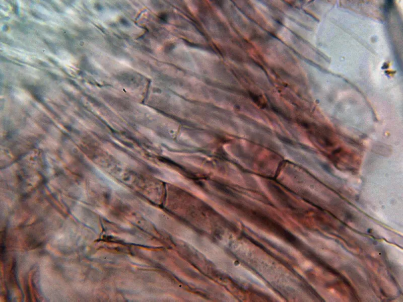 Amanita ovoidea 25 -  Hifas volva